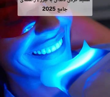 سفید کردن دندان با لیزر | راهنمای جامع 2025