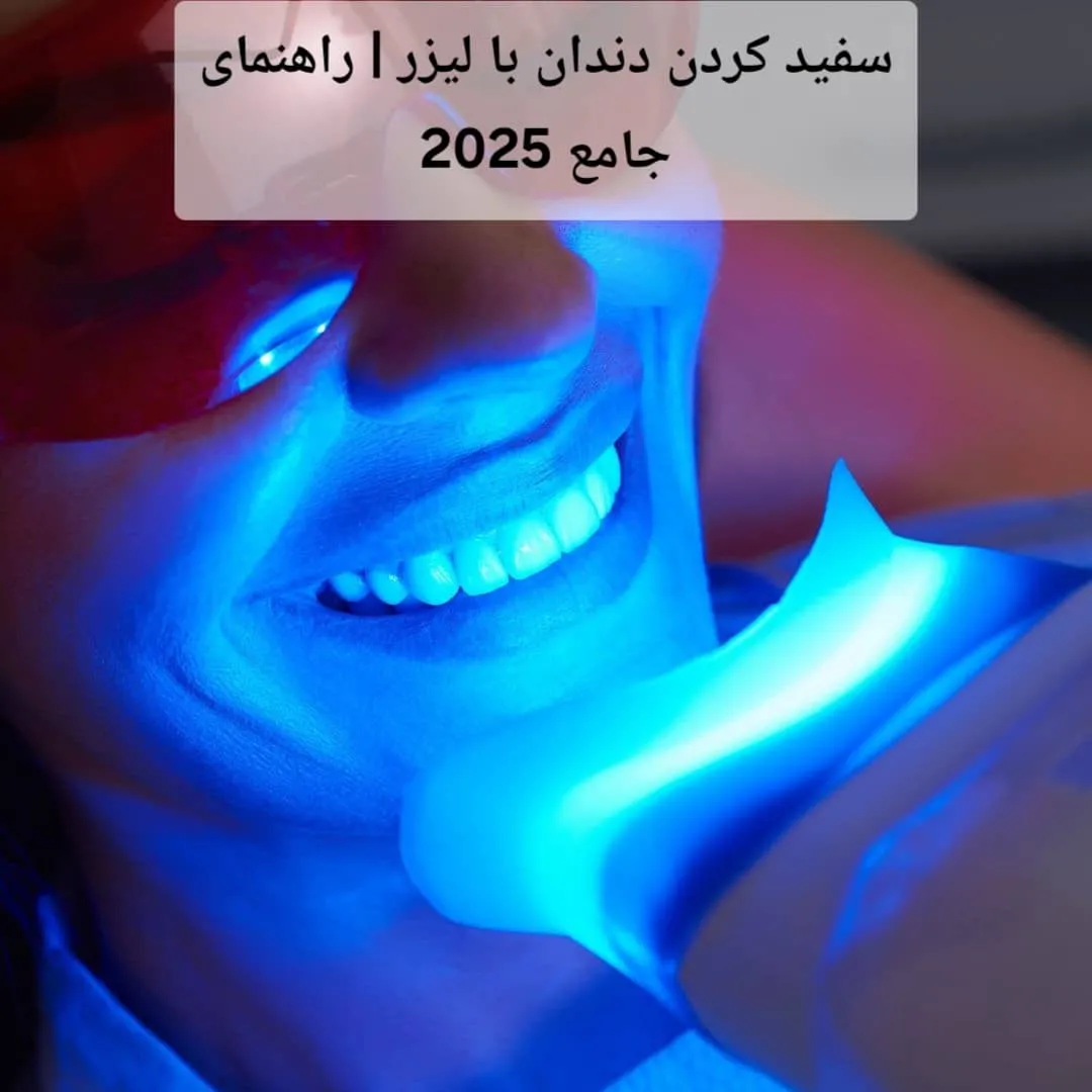 سفید کردن دندان با لیزر | راهنمای جامع 2025