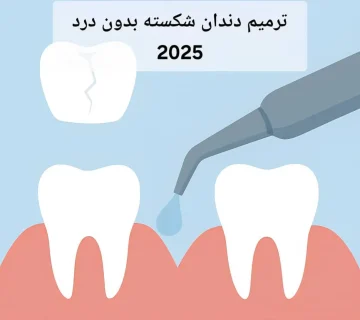 ترمیم دندان شکسته بدون درد 2025