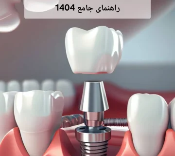مراقبت‌های بعد از ایمپلنت دندان | راهنمای جامع 1404
