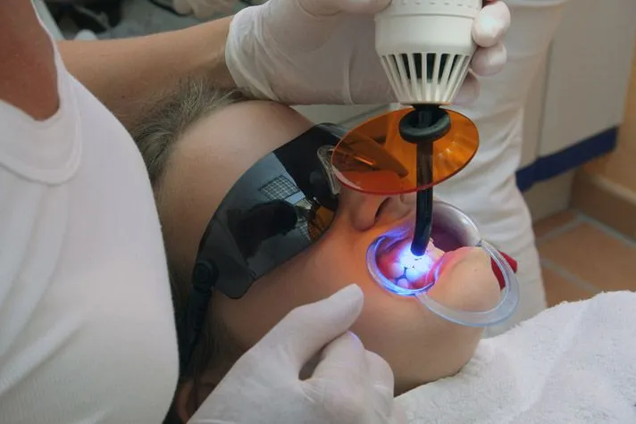 دندانپزشکی بدون درد با لیزر | راهنمای کامل 2025