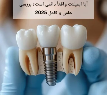 آیا ایمپلنت واقعاً دائمی است؟ بررسی علمی و کامل 2025