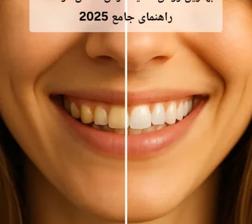 بهترین روش سفید کردن دندان در خانه | راهنمای جامع 2025