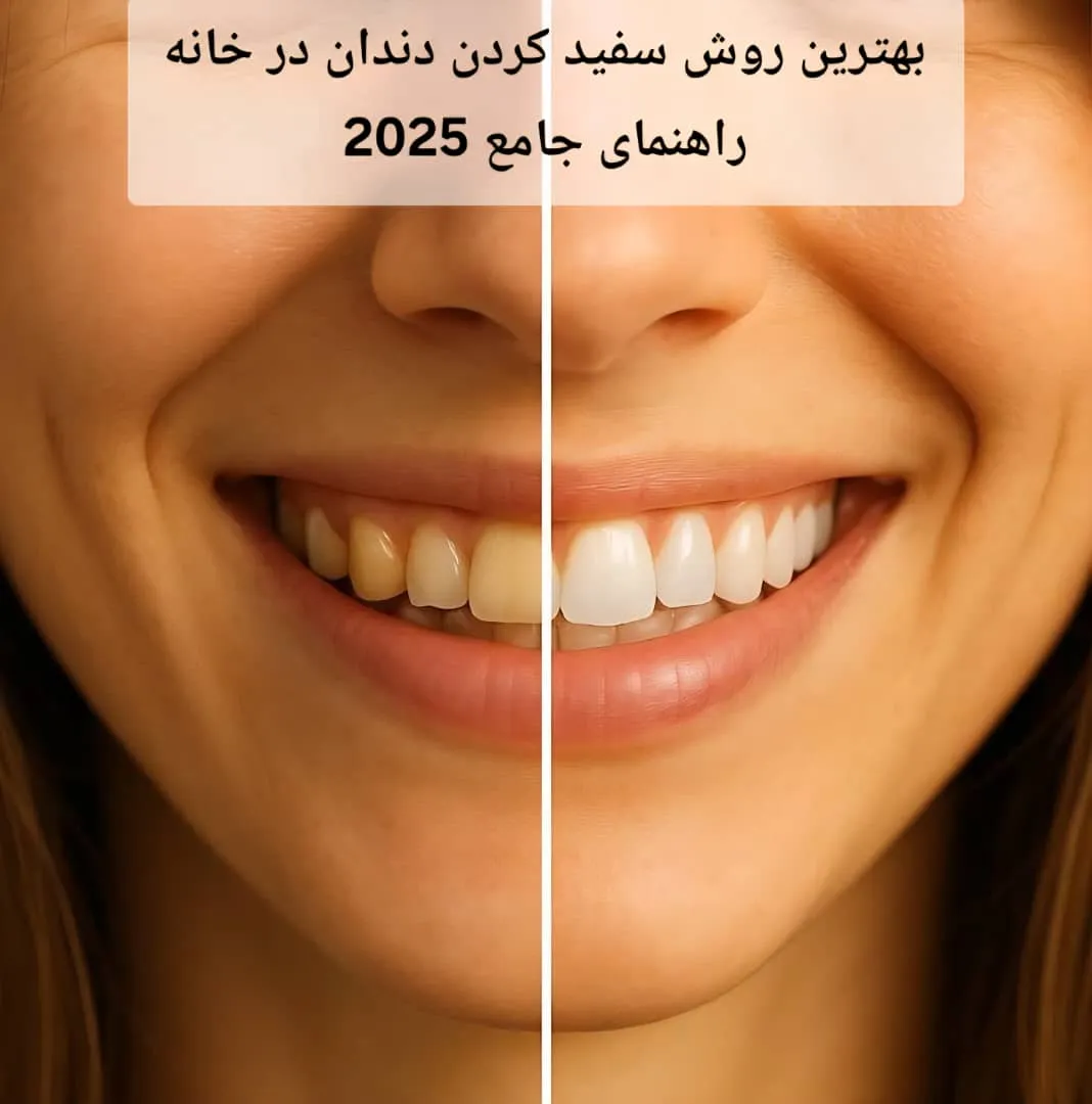 بهترین روش سفید کردن دندان در خانه | راهنمای جامع 2025