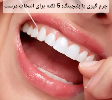 جرم گیری یا بلیچینگ: 5 نکته برای انتخاب درست
