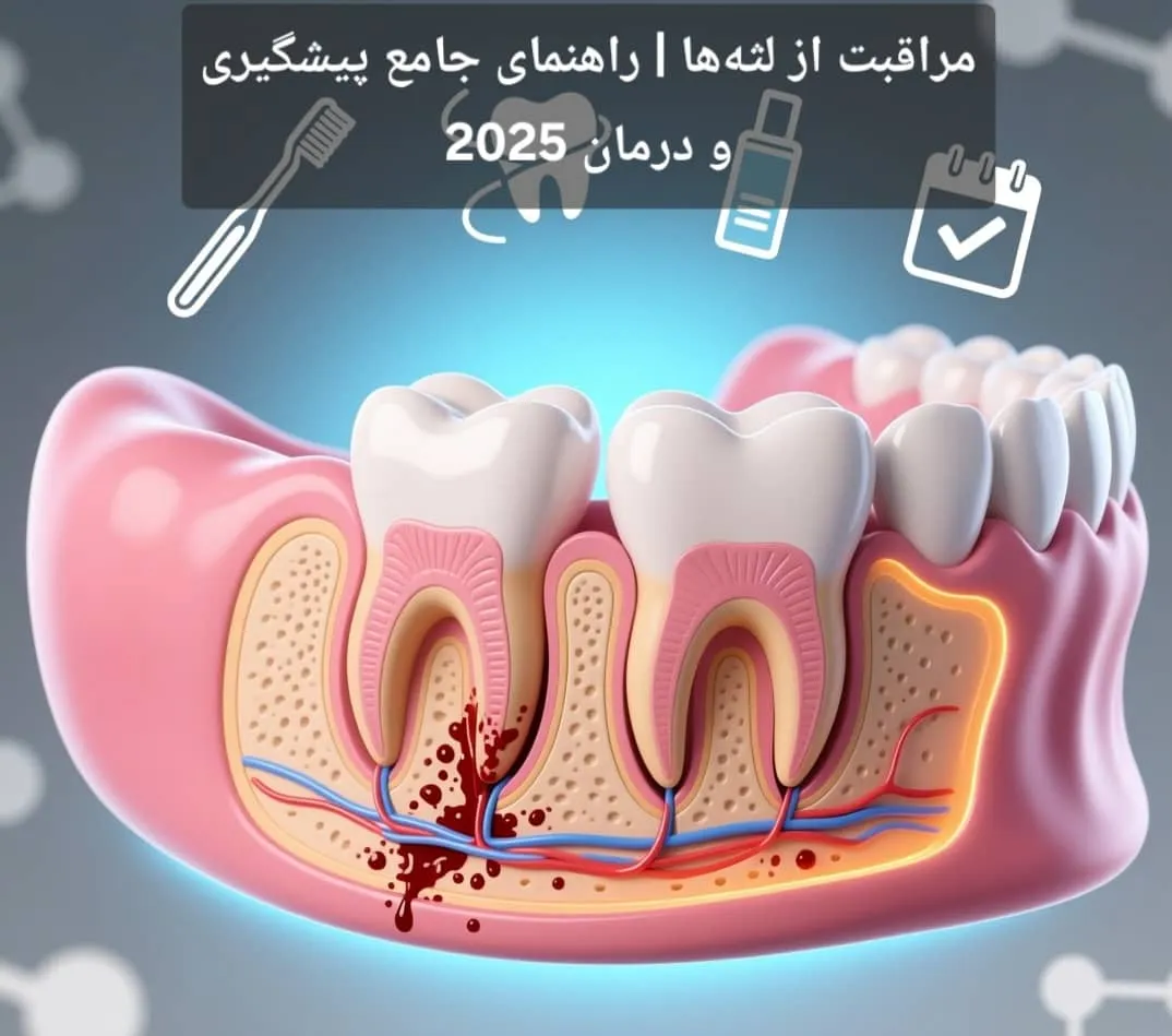 مراقبت از لثه‌ها | راهنمای جامع پیشگیری و درمان 2025