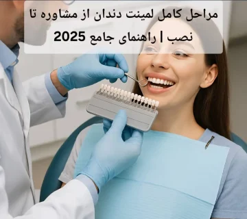 مراحل کامل لمینت دندان از مشاوره تا نصب | راهنمای جامع 2025