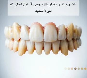 علت زرد شدن دندان ها؛ بررسی 7 دلیل اصلی که نمی‌دانستید