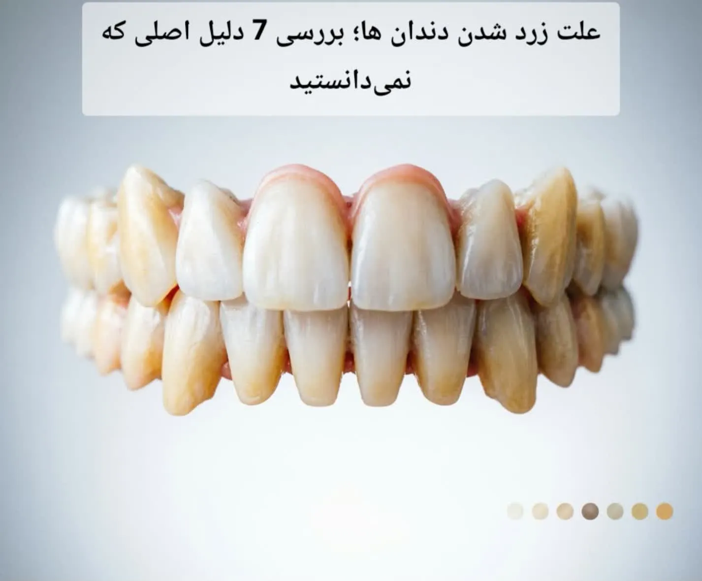 علت زرد شدن دندان ها؛ بررسی 7 دلیل اصلی که نمی‌دانستید