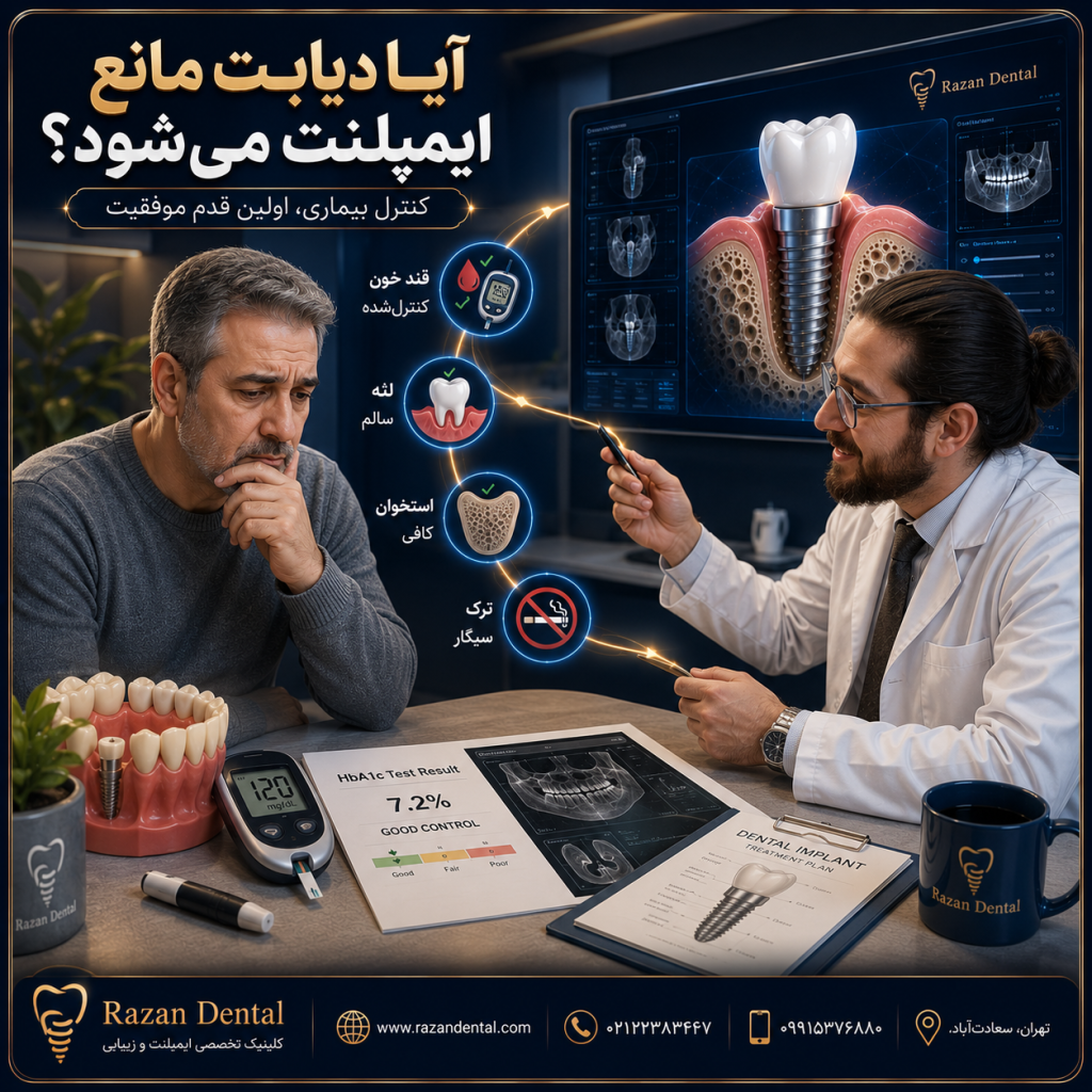 ایمپلنت در بیماران دیابتی؛ شرایط و میزان موفقیت