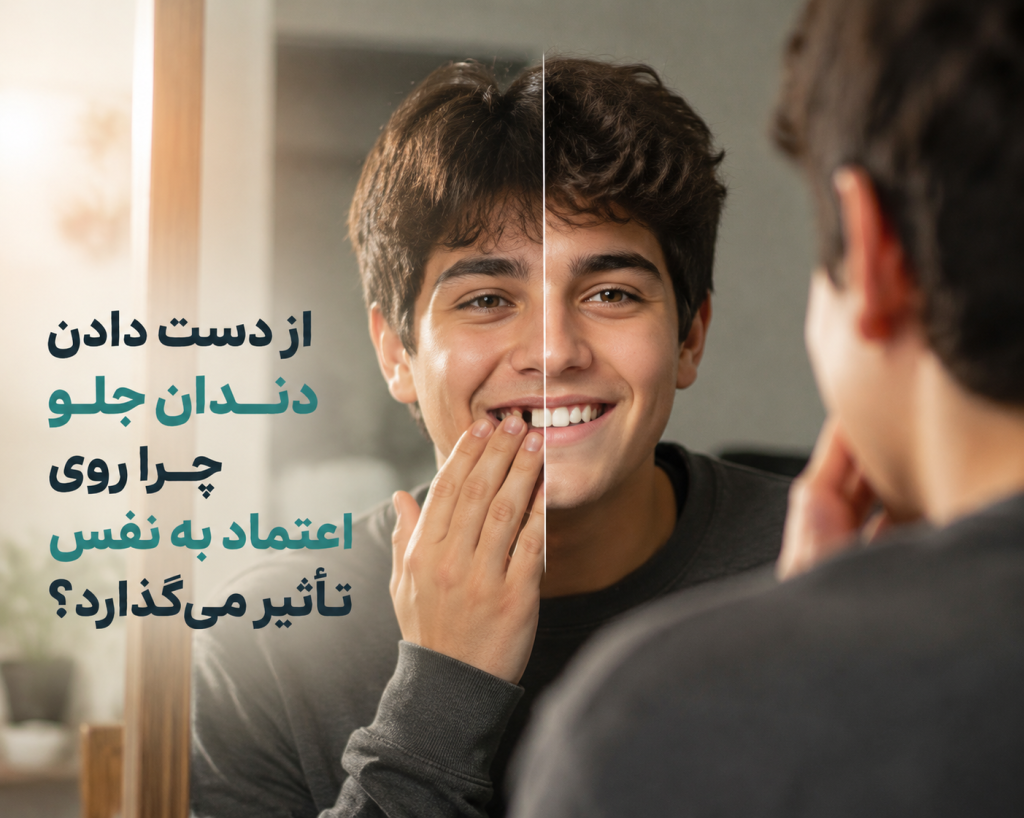 ایمپلنت دندانهای جلویی؛ طبیعیترین روش جایگزینی دندان