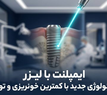 ایمپلنت با لیزر