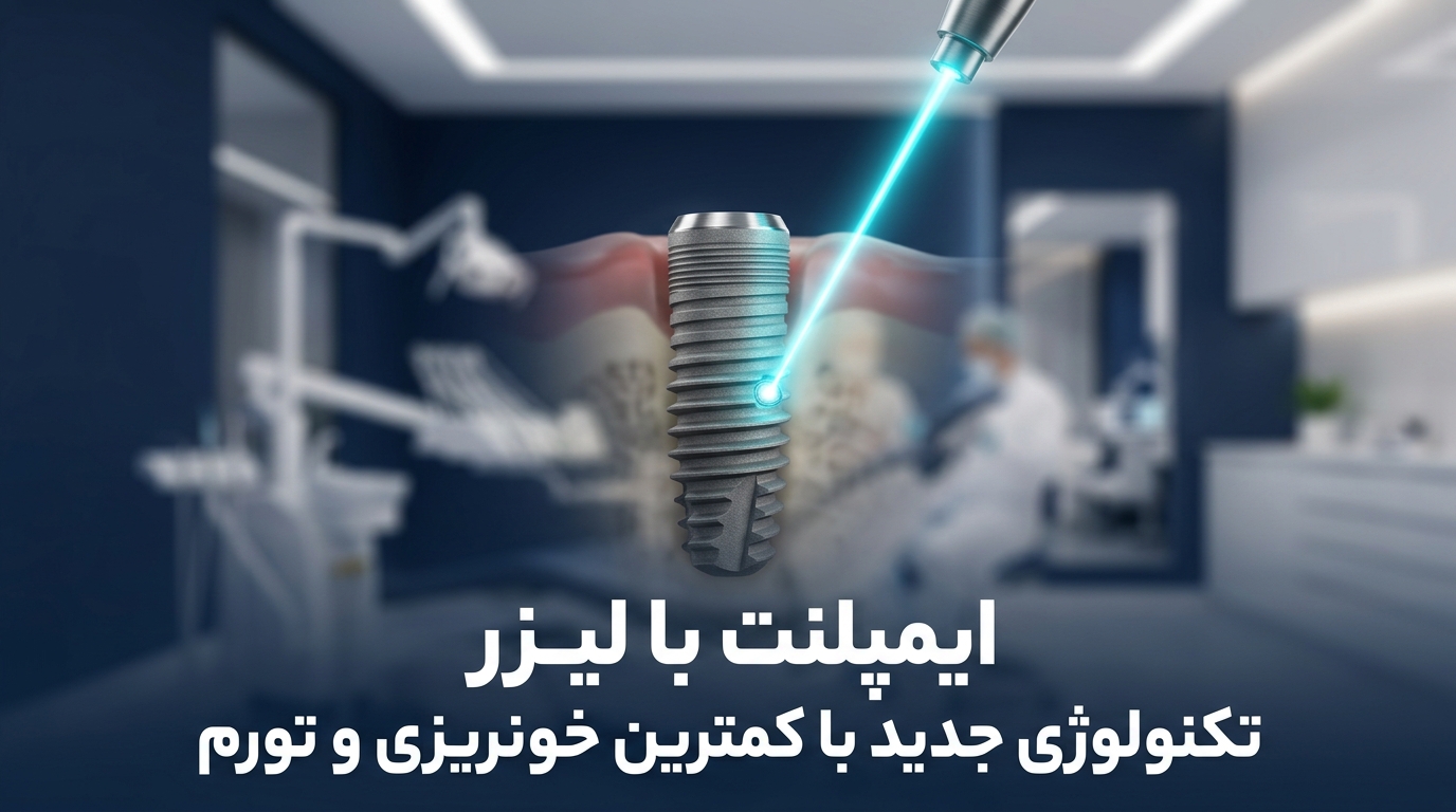 ایمپلنت با لیزر