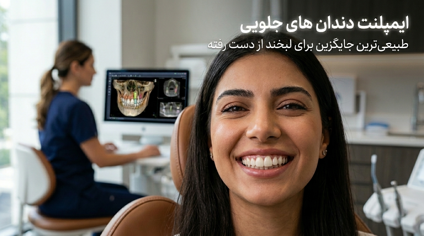 ایمپلنت دندان های جلویی