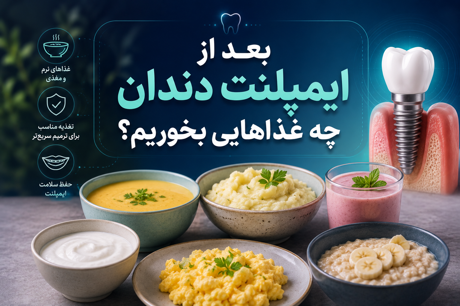 بعد از ایمپلنت دندان چه غذاهایی بخوریم؟