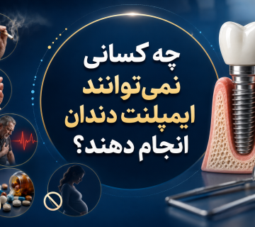 چه کسانی نمی‌توانند ایمپلنت دندان انجام دهند؟