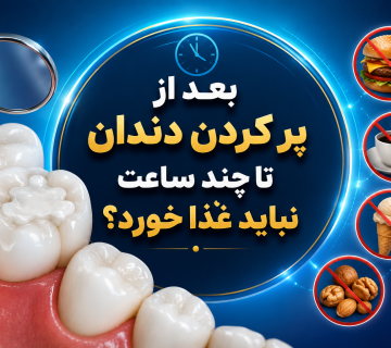 بعد از پر کردن دندان تا چند ساعت نباید غذا خورد؟