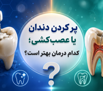 پر کردن دندان یا عصب‌کشی؛ کدام درمان بهتر است؟