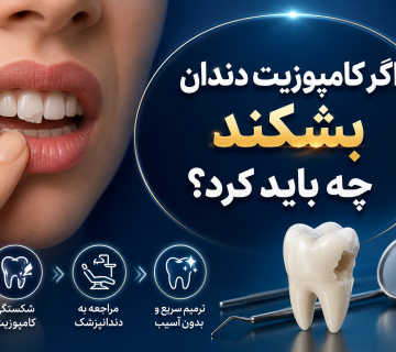 اگر کامپوزیت دندان بشکند چه باید کرد؟
